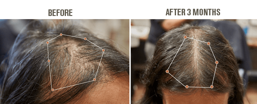 HAIR THICKENING TONIC | THE ANTI-HAIR LOSS TONIC TenT London