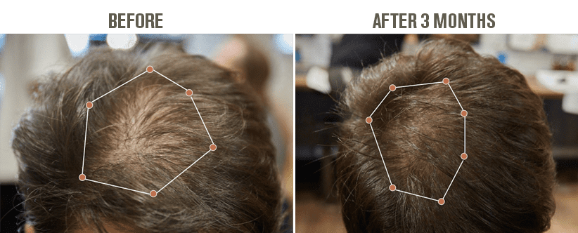 HAIR THICKENING TONIC | THE ANTI-HAIR LOSS TONIC