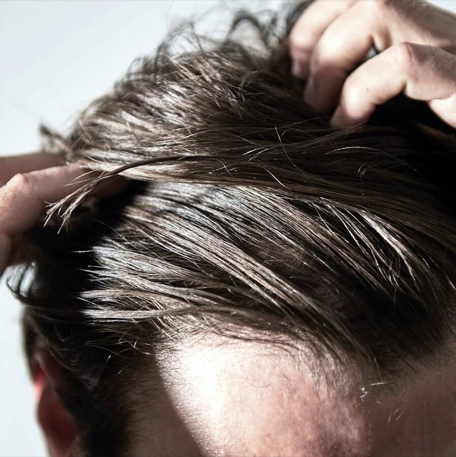 Myths About Hair Loss