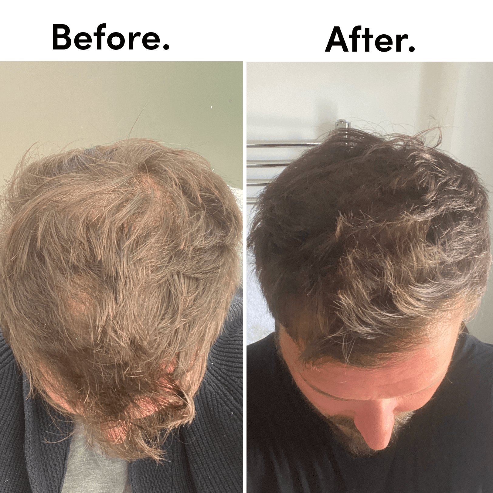 tent hair THICKENING TONIC Model:TL 09-14 Orbea Orca Aero 360°: E46-Fluids