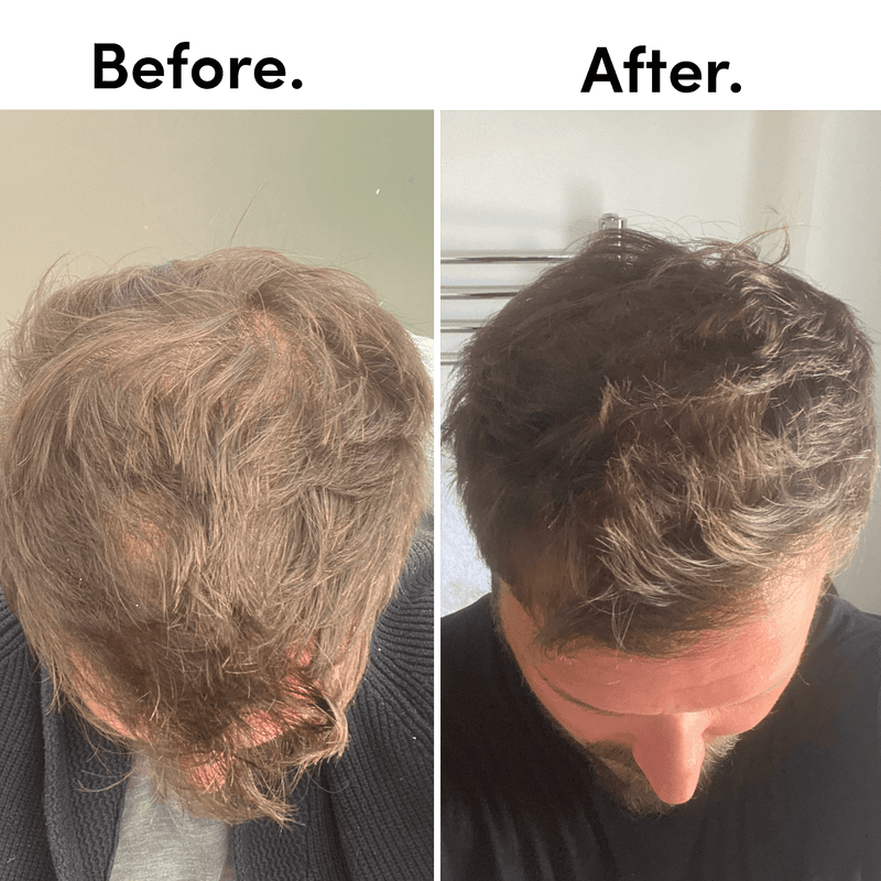 Tent London Before And After