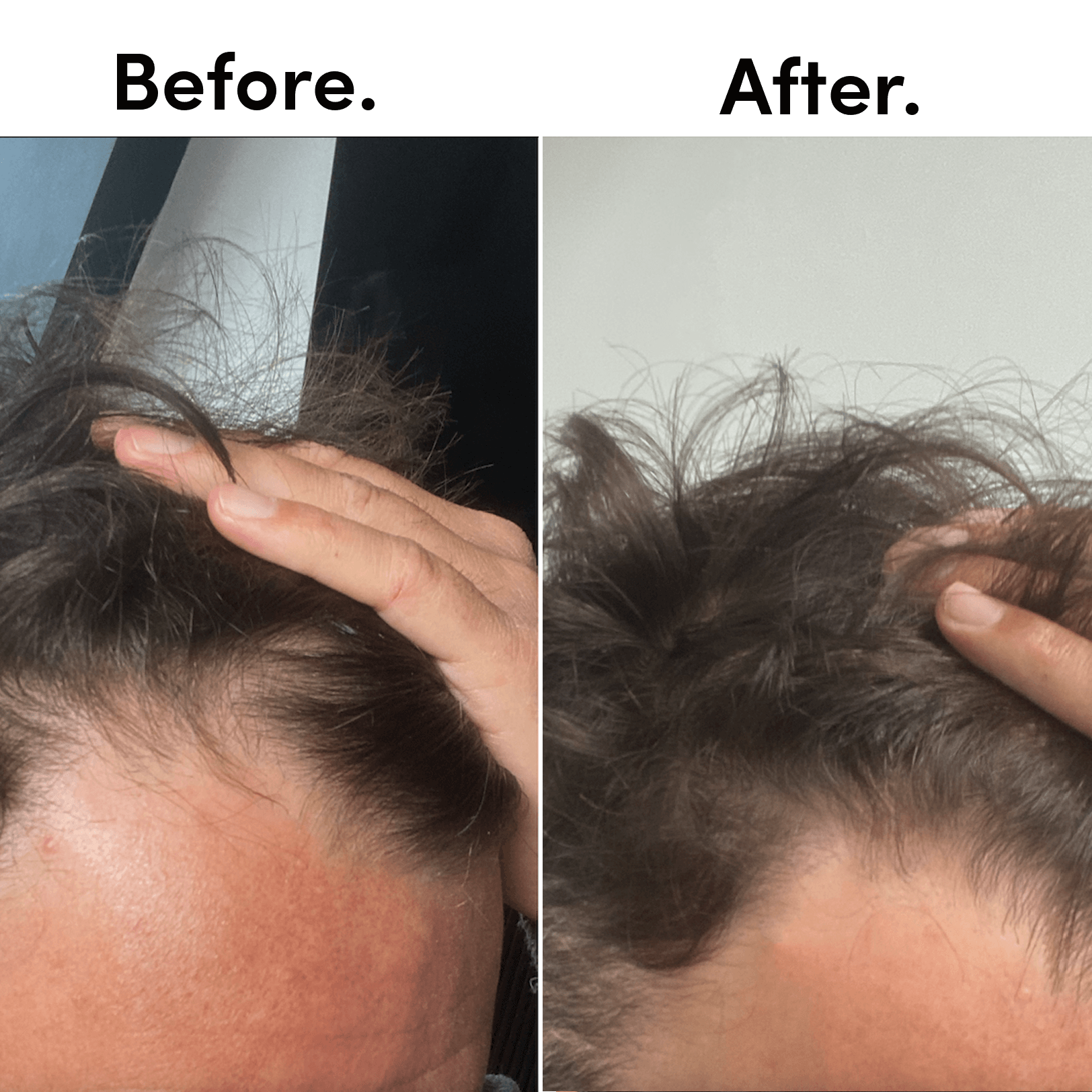 tent hair 2 PACK HAIR THICKENING TONIC