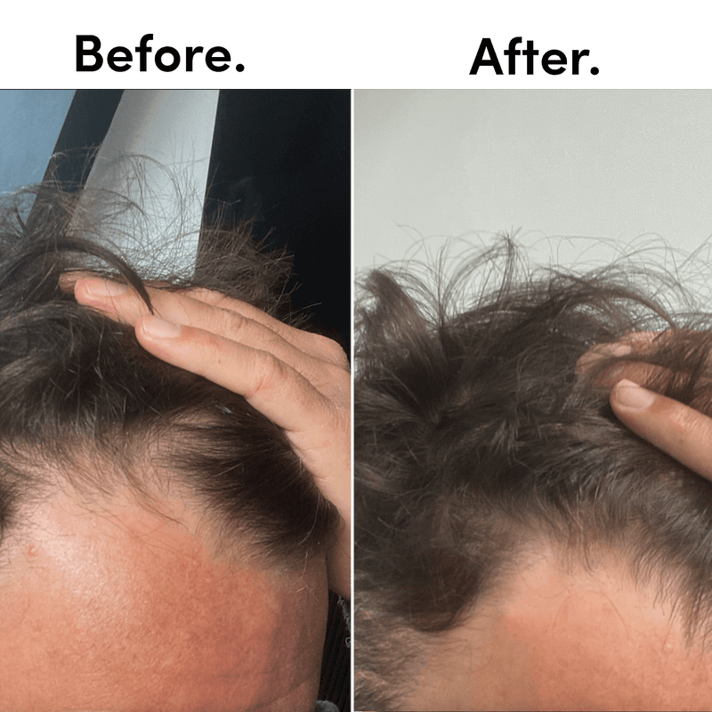 TENT LONDON BEFORE AND AFTER