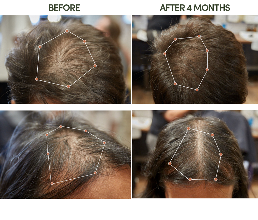 TENT HAIR TONIC before and after